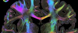 FiberOrientationMap HumanBrain