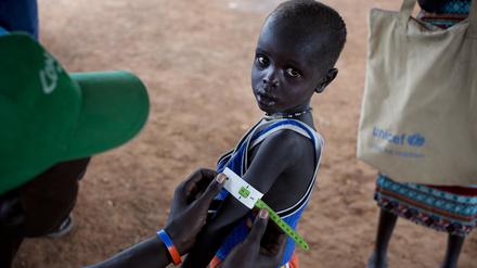 Ein Mann misst den Armumfang eines Jungen in einer Hilfeeinrichtung, die von der UNICEF unterstützt wird. Er untersucht, ob das Kind an Unterernährung leidet.