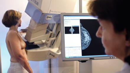 Ab 2024 können nun auch Frauen zwischen 70 bis 75 Jahren die Vorsorgeuntersuchung in Anspruch nehmen. 