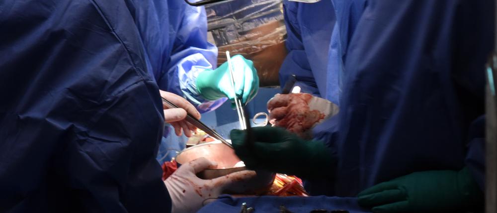 Chirurgen der Universität Maryland transplantierten einem 58-jährigen Herzpatienten ein Schweinenerz, um sein Leben zu retten.