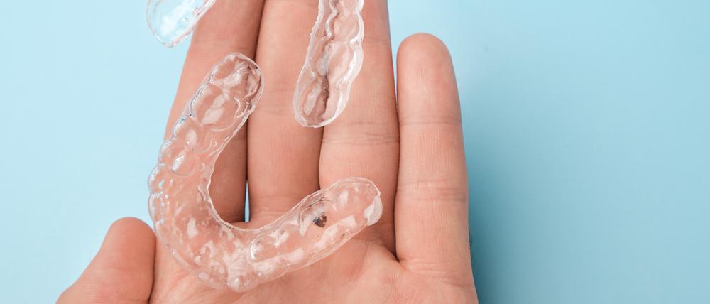 Aligner sind dünn, kaum sichtbar und können jederzeit aus dem Mund herausgenommen werden.