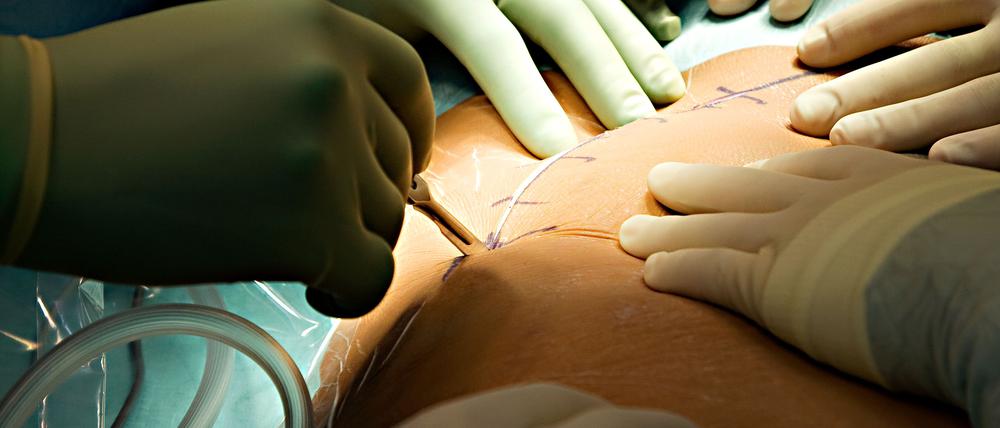 Wie gut sind Berlins Krankenhäuser?