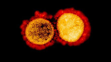 Transmission electron micrograph of SARS-CoV-2 virus particles, isolated from a patient. Image captured and color-enhanced at the NIAID Integrated Research Facility (IRF) in Fort Detrick, Maryland. Credit: NIAID