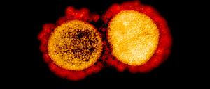 Transmission electron micrograph of SARS-CoV-2 virus particles, isolated from a patient. Image captured and color-enhanced at the NIAID Integrated Research Facility (IRF) in Fort Detrick, Maryland. Credit: NIAID