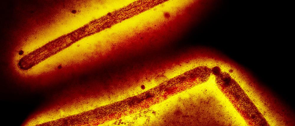 Die derzeit vor allem unter Tieren kursierenden H5N1-Influenzaviren sind nicht leicht von Mensch zu Mensch übertragbar, aber das könnte sich durch Mutationen ändern.