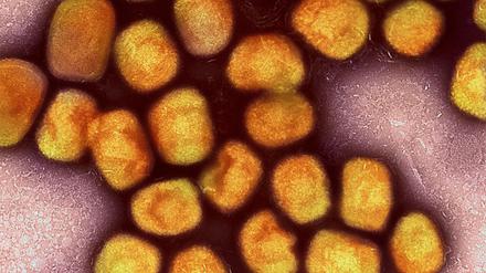 Eine kolorierte transmissionselektronenmikroskopische Aufnahme von Partikeln des Affenpockenvirus (Gold), kultiviert und gereinigt aus einer Zellkultur, aufgenommen in der NIAID Integrated Research Facility, veröffentlicht am 26. Juli 2022, in Fort Detrick, Maryland.