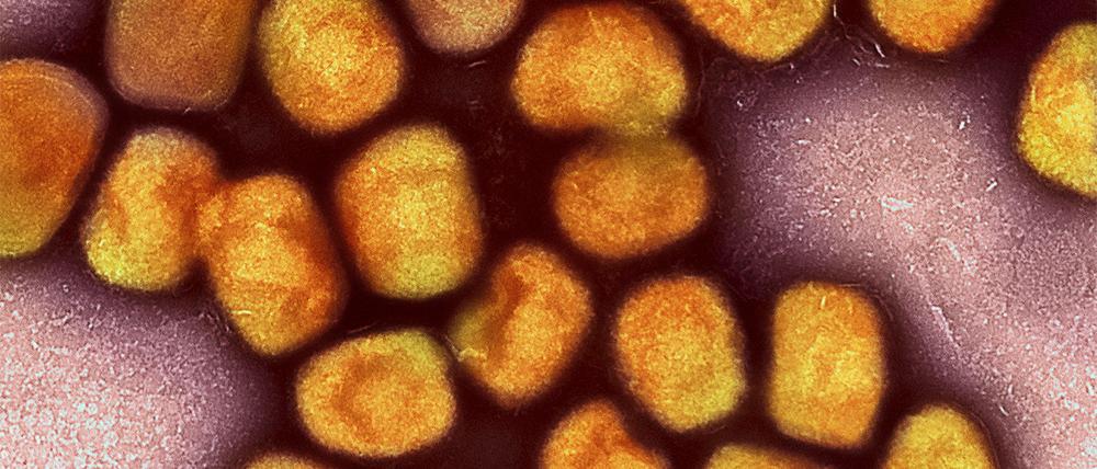 Eine kolorierte transmissionselektronenmikroskopische Aufnahme von Partikeln des Affenpockenvirus (Gold), kultiviert und gereinigt aus einer Zellkultur, aufgenommen in der NIAID Integrated Research Facility, veröffentlicht am 26. Juli 2022, in Fort Detrick, Maryland.