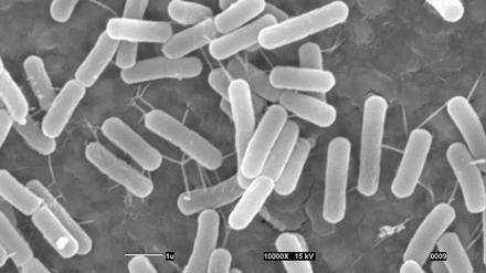 Das Urzeit-Bakterium wurde der Gattung von Bacillus sphaericus zugeordnet.