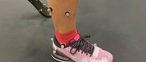 Das Laufbild wird mithilfe von Markern an den Beinen genau analysiert.