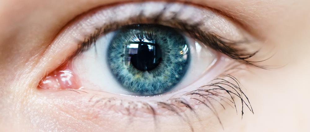 Nahaufnahme eines Auges mit blauer Iris. (Symbolbild)