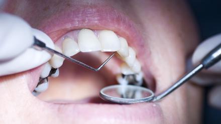 "patient having a dental examination up, close up with narrow depth of field focus on probe"