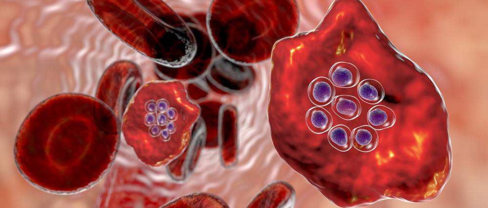 Mit Malaria infizierte rote Blutzelle.