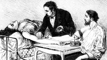Diese Transfusion 1882 in Genf gelang, weil der Spender zufällig passte.