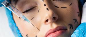 Wer schön sein will, nimmt Botox?