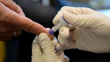 Die Zahl der HIV-Schwerpunktpraxen droht deutlich zu schrumpfen.