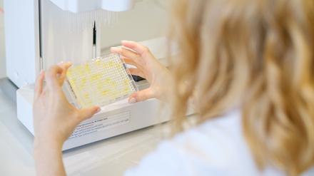 Die Geschlechterlücke bei den meistzitierten Wissenschaftlern weltweit wird einer neuen Studie zufolge kleiner.