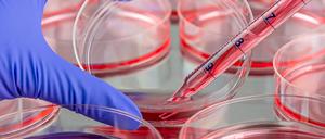 Gen- und Zelltherapien versprechen Heilung bei schweren Krankheiten. Die Arbeitsgruppe Gentechnologiebericht analysiert und bewertet diese neuen Verfahren. 