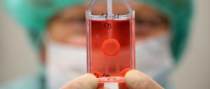 ARCHIV - 05.12.2016, Mecklenburg-Vorpommern, Rostock: In einer Gewebebank im Biomedizinischen Forschungszentrum (BMFZ) Rostock zeigt eine Mitarbeiterin eine präparierte Hornhaut eines Auges.