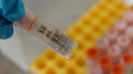 Eingefrorene Stuhlprobe in einem Gläschen – Schweizer Wissenschaftler wollen einen Tresor für Darmbakterien aus aller Welt anlegen.