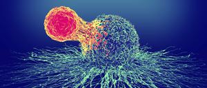 Immunzellen töten andere Zellen des Körpers, wenn sie krankhaft verändert sind. Schießen sie über das Ziel hinaus, kommt es zu Autoimmunerkrankungen.