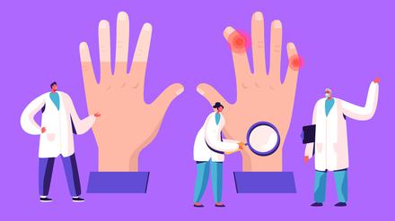 Beim Raynaud-Syndrom verursachen Kälte und Stress in den Fingern eine Durchblutungsstörung – erst werden die Finger weiß, dann blau, dann rot.