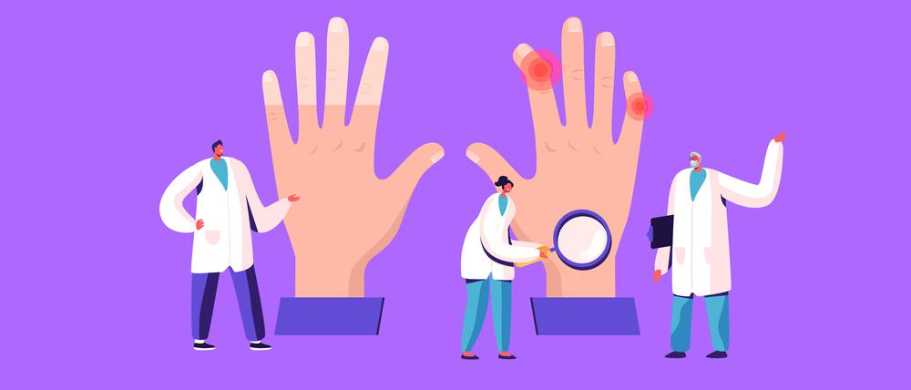 Beim Raynaud-Syndrom verursachen Kälte und Stress in den Fingern eine Durchblutungsstörung – erst werden die Finger weiß, dann blau, dann rot.