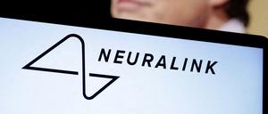Neuralink von Techmilliardär Elon Musk implantierte erstmals einen Chip zur Gedankensteuerung von technischen Geräten in ein menschliches Gehirn.