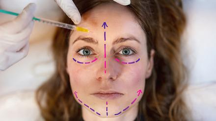 Unterm Messer: Beauty-OPs, Botox und die Suche nach sich selbst.