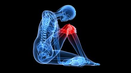 Darstellung eines menschlichen Skeletts, bei dem das Knie rot leuchtet. 