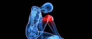 Darstellung eines menschlichen Skeletts, bei dem das Knie rot leuchtet. 