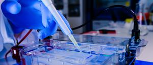 Mitunter werden die Ergebnisse von Gelelektrophoresen, mit denen etwa DNA untersucht wird, von betrügenden Wissenschaftlern manipuliert. 