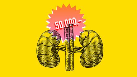 Die Menschen in Deutschland vermeiden die Auseinandersetzung mit der Organspende. Sollte man sie mit Geld ködern? Es gibt ein paar Ideen und sehr viele Vorbehalte.