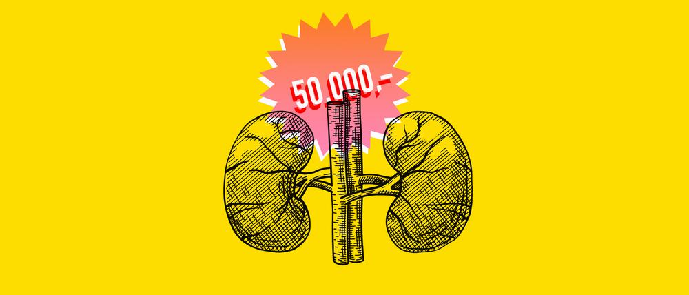 Die Menschen in Deutschland vermeiden die Auseinandersetzung mit der Organspende. Sollte man sie mit Geld ködern? Es gibt ein paar Ideen und sehr viele Vorbehalte.
