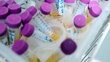In den Proben von zahlreichen Kleinkindern aus Nordrhein-Westfalen konnte der Weichmacher Di-n-hexyl-Phthalat (DnHexP), der die Fruchtbarkeit schädigen soll, nachgewiesen werden. 
