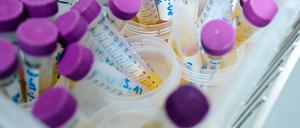 In den Proben von zahlreichen Kleinkindern aus Nordrhein-Westfalen konnte der Weichmacher Di-n-hexyl-Phthalat (DnHexP), der die Fruchtbarkeit schädigen soll, nachgewiesen werden.