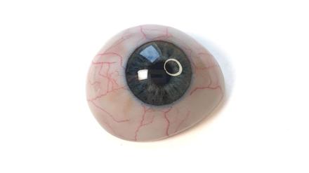 3D-gedruckte Augenprothese. 