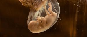 Menschlicher Embryo in Fruchtwasser-gefüllter Fruchtblase