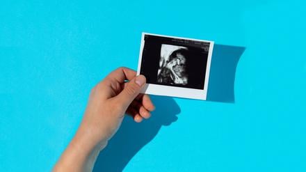 Ein Ultraschallbild symbolisiert den Babywunsch.