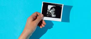 Ein Ultraschallbild symbolisiert den Babywunsch.
