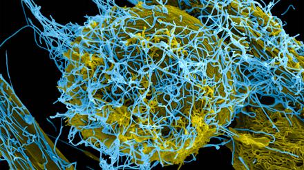 Ebola-Viren (blau koloriert) werden fast nie über Samen oder Speichel verbreitet, weil darin Massen winziger Fettbläschen enthalten sind, die den Erregern den Weg in die Zellen erschweren.
