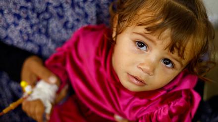 Tausende Kinder leiden im Gazastreifen an Unterernährung und brauchen dringende medizinische Hilfe.