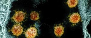 Partikel des Coronavirus SARS-CoV-2 wurden für eine elektronenmikroskopische Aufnahme am «National Institute of Allergy and Infectious Diseases Integrated Research Facility» farblich bearbeitet.