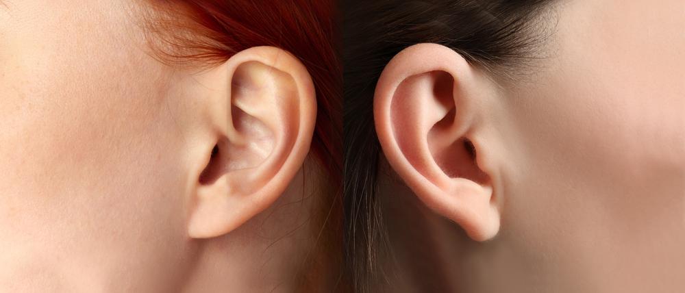 Ohrläppchen, links angewachsen, rechts frei hängend.