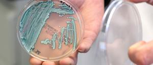 Der Hefepilz Candida auris kann Menschen krank machen und ist resistent gegen zahlreiche Medikamente.