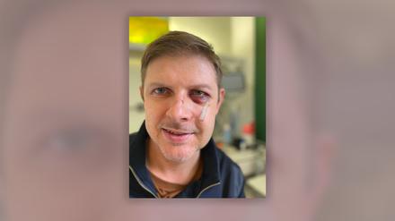 Foto von Matthias Ecke von seinem Twitter-Account