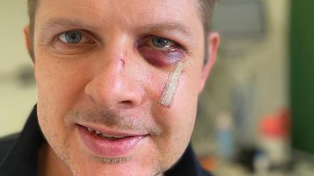 Der SPD-Europaabgeordnete Matthias Ecke hat sich mit einem Dank aus dem Krankenhaus gemeldet.
