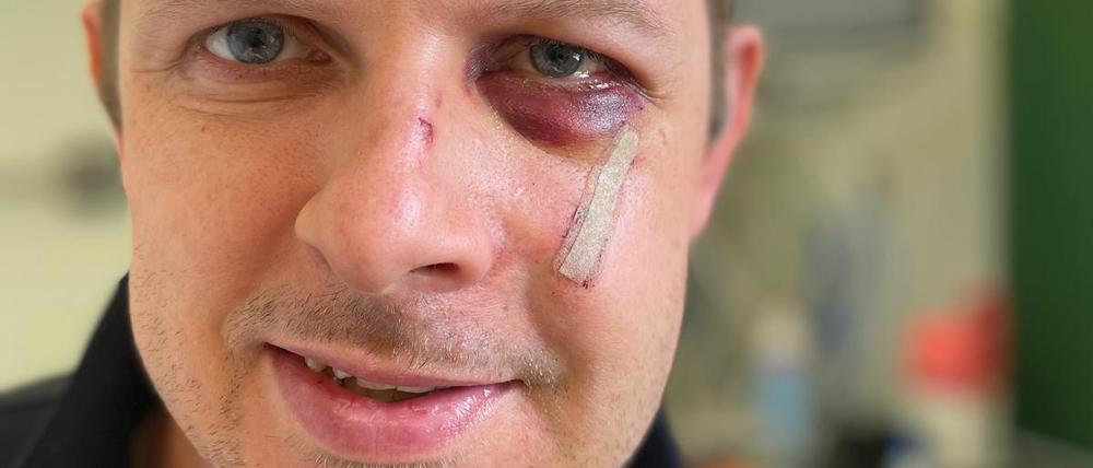 Der SPD-Europaabgeordnete Matthias Ecke hat sich mit einem Dank aus dem Krankenhaus gemeldet.