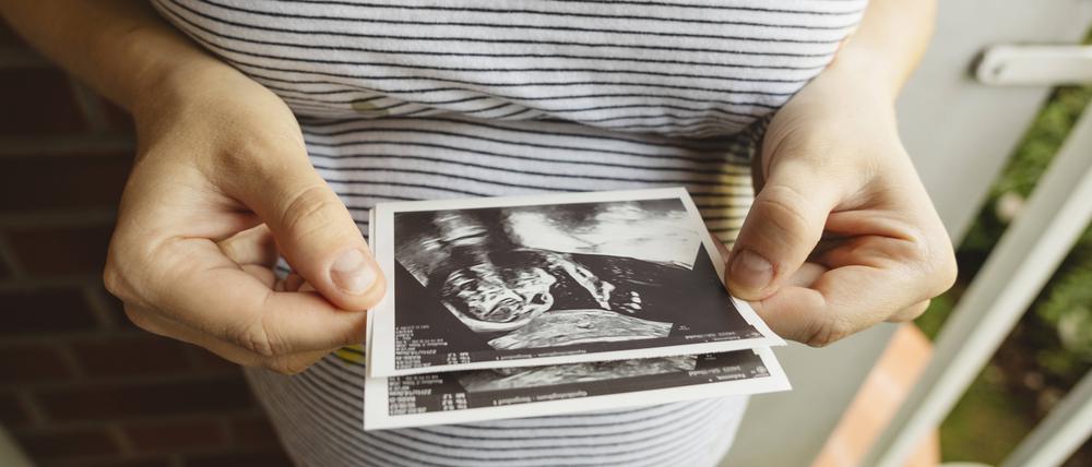 Frau mit Ultraschallbild