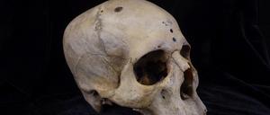 Der 4000 Jahre alte Schädel „E236“ eines etwa 30-jährigen Mannes aus dem alten Ägypten zeigt Löcher, um die herum feinste Spuren von scharfen Messern zu erkennen sind, die Forschenden zufolge die ältesten Spuren einer Krebsoperation darstellen könnten. 