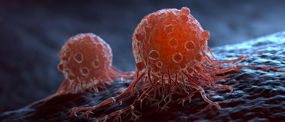 Cancer cells can migrate to other body tissues or organs building metastasis. 3D illustration